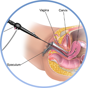 Laparohysteroscopy